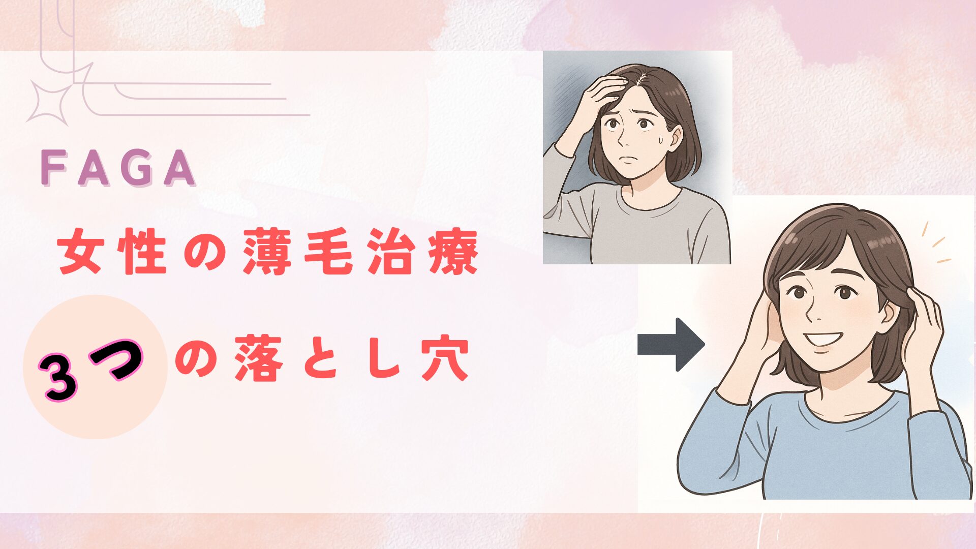 FAGA女性の薄毛治療３つの落とし穴